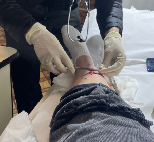 Profunda herida sufri&oacute; joven mordida por perro en pleno centro de Sarand&iacute; Grande